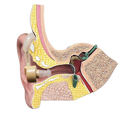 AUDIFONOS DE ESCUCHA Y6 - VUELVE A  ESCUCHAR COMO  ANTES